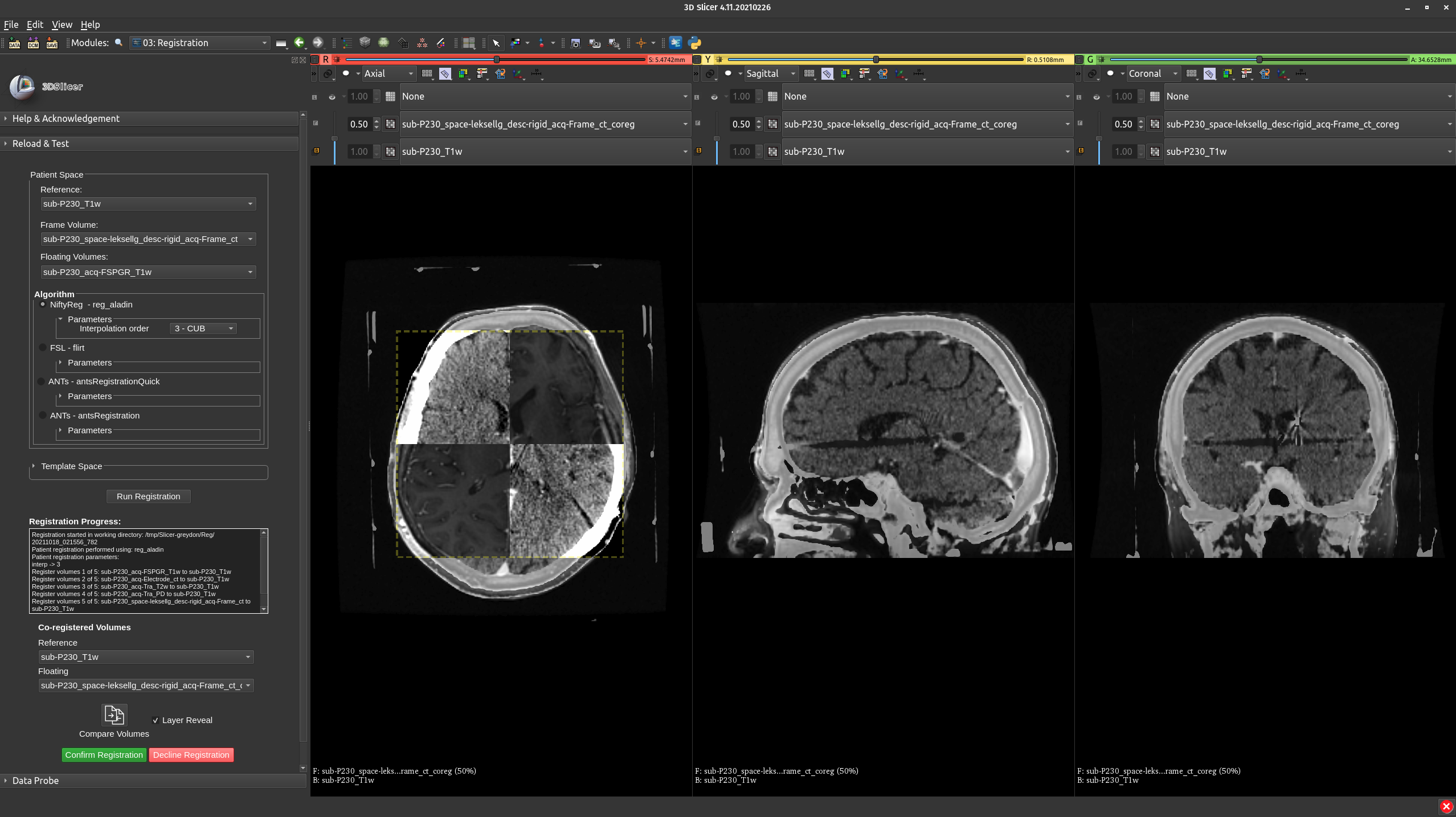 !Preoperative planning.