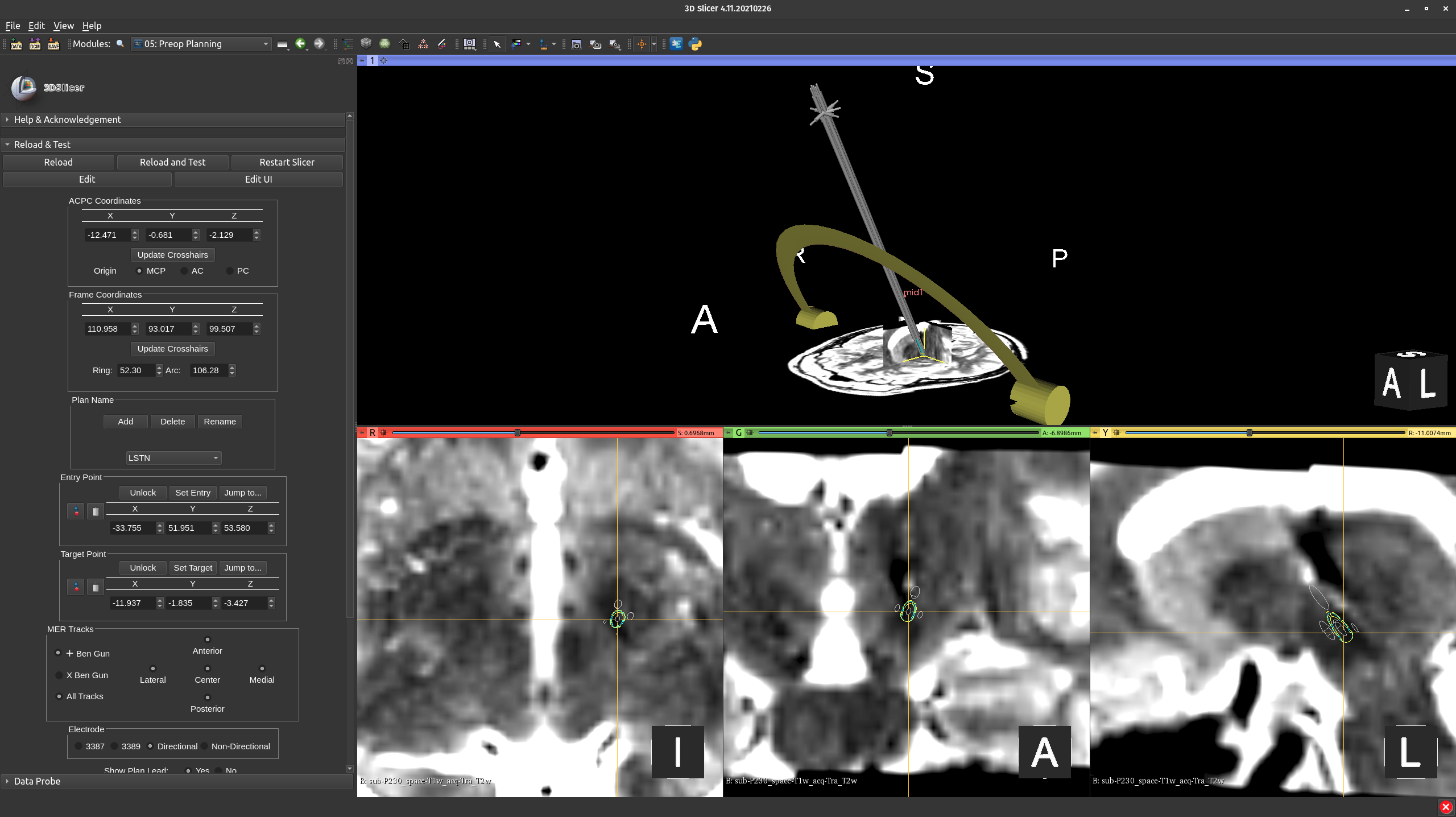 !Perioperative planning.